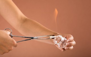 拔罐黑紫色说明什么？拔罐后身体反应解读